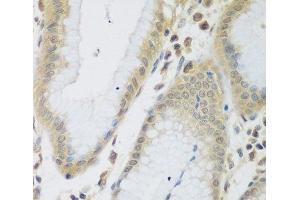 Immunohistochemistry of paraffin-embedded Human stomach using ENPEP Polyclonal Antibody at dilution of 1:200 (40x lens). (ENPEP anticorps)