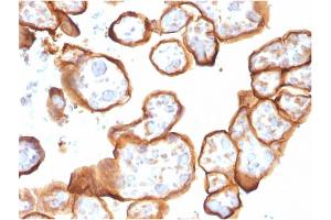 Formalin-fixed, paraffin-embedded human Placenta stained with Thrombomodulin/CD141 Monoclonal Antibody (THBD/1591).