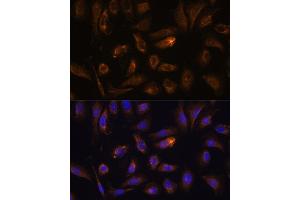 Immunofluorescence analysis of U-2 OS cells using RGS4 antibody (ABIN7269898) at dilution of 1:100.