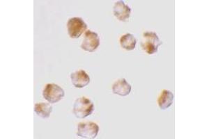 Immunocytochemistry staining of K562 cells usingAcinus Antibody Cat. (ACIN1 anticorps)