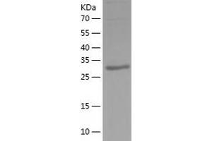 Western Blotting (WB) image for PIH1 Domain Containing 2 (PIH1D2) (AA 1-315) protein (His-IF2DI Tag) (ABIN7124451)