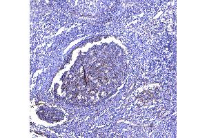 IHC analysis of TAPA1 using anti-TAPA1 antibody .