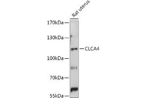 Western blot analysis of extracts of Rat uterus, using CLC antibody (ABIN7266332) at 1:1000 dilution. (CLCA4 anticorps  (AA 22-150))