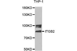 Western blot analysis of extracts of THP-1 cell lines, using ITGB2 antibody. (Integrin beta 2 anticorps  (AA 70-170))