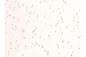 ABIN6267244 at 1/100 staining human heart tissue sections by IHC-P.