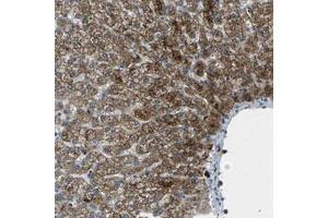 Immunohistochemical staining (Formalin-fixed paraffin-embedded sections) of human liver with SIGLEC14 polyclonal antibody  shows strong cytoplasmic positivity in a granular pattern in hepatocytes at 1:20-1:50 dilution. (SIGLEC14 anticorps)