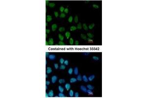 ICC/IF Image Immunofluorescence analysis of paraformaldehyde-fixed Human ESC, using ZNF281, antibody at 1:100 dilution. (ZNF281 anticorps)