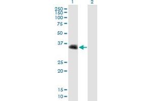 Western Blot analysis of CENPV expression in transfected 293T cell line by CENPV MaxPab polyclonal antibody. (CENPV anticorps  (AA 1-275))