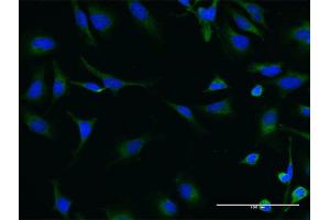 Immunofluorescence of monoclonal antibody to SIK2 on HeLa cell.