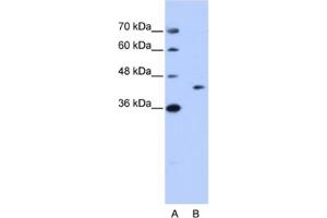 Western Blotting (WB) image for anti-GIPC PDZ Domain Containing Family, Member 1 (GIPC1) antibody (ABIN2462192) (GIPC1 anticorps)