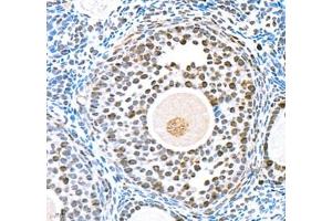 Immunohistochemistry of paraffin embedded mouse ovary using Top2 (ABIN7075937) at dilution of 1:600 (400x lens)