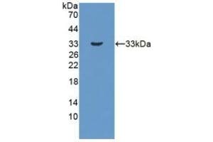 Detection of Recombinant HSD17b3, Human using Polyclonal Antibody to 17-Beta-Hydroxysteroid Dehydrogenase Type 3 (HSD17b3) (HSD17B3 anticorps  (AA 1-310))