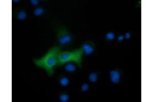 Immunofluorescence (IF) image for anti-Epoxide Hydrolase 2, Cytoplasmic (EPHX2) antibody (ABIN1500855) (EPHX2 anticorps)
