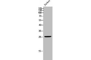 Western Blot analysis of JK cells using Phospho-Bcl-2 (S70) Polyclonal Antibody (Bcl-2 anticorps  (pSer70))