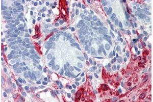 Human Small Intestine: Formalin-Fixed, Paraffin-Embedded (FFPE)