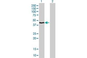 Western Blot analysis of HMBS expression in transfected 293T cell line by HMBS monoclonal antibody (M01), clone 3E8. (HMBS anticorps  (AA 1-361))