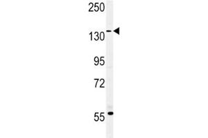 MUC1 antibody western blot analysis in MDA-MB435 lysate.