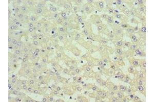 Immunohistochemistry of paraffin-embedded human liver tissue using ABIN7171013 at dilution of 1:100 (SUFUH anticorps  (AA 325-484))