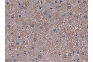 Detection of C5a in Human Liver Tissue using Polyclonal Antibody to Complement Component 5a (C5a)