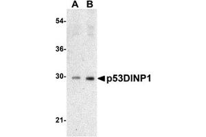 Western Blotting (WB) image for anti-Tumor Protein P53 Inducible Nuclear Protein 1 (TP53INP1) (N-Term) antibody (ABIN1031500) (TP53INP1 anticorps  (N-Term))