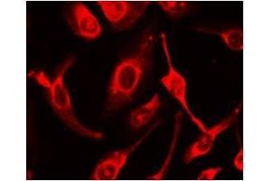 Immunocytochemical staining of HeLa Cells (FAS anticorps  (N-Term))