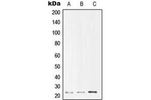 Western blot analysis of UBE2T expression in Jurkat (A), HepG2 (B), HeLa (C) whole cell lysates. (Ube2t anticorps  (Center))