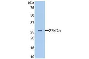 Detection of Recombinant CLU, Mouse using Polyclonal Antibody to Clusterin (CLU) (Clusterin anticorps  (AA 227-448))