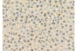 ABIN6258570 and ABIN6274563 at 1/100 staining Rat liver tissue by IHC-P.