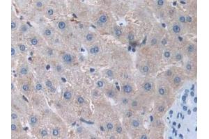 DAB staining on IHC-P; Samples: Human Liver Tissue (MMP15 anticorps  (AA 280-497))
