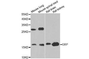 Western blot analysis of extracts of various cell lines, using GRP antibody. (Gastrin-Releasing Peptide anticorps  (AA 1-148))