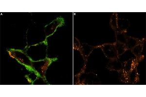 Live cell imaging of MmTx1 Toxin-ATTO Fluor-488 in intact human  cells expressing GABRB3.