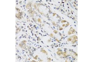 Immunohistochemistry of paraffin-embedded human stomach using RETN antibody at dilution of 1:100 (40x lens). (Resistin anticorps)