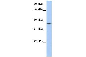 TMCC1 antibody used at 1 ug/ml to detect target protein. (TMCC1 anticorps  (C-Term))