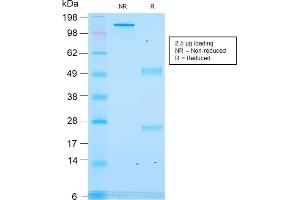 SDS-PAGE Analysis Purified ACTH Recombinant Mouse Monoclonal Antibody (rCLIP/1418). (Recombinant POMC anticorps  (AA 25-39))