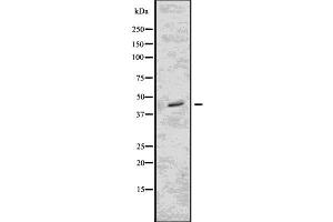 Western blot analysis of FCGR2B using Jurkat whole  lysates. (FCGR2B anticorps  (C-Term))