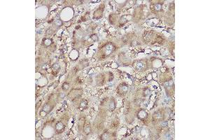 Immunohistochemistry of paraffin-embedded human liver using NDUFB8 Rabbit pAb (ABIN7268814) at dilution of 1:100 (40x lens). (NDUFB8 anticorps)