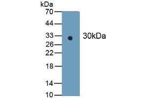 Detection of Recombinant IDH1, Human using Monoclonal Antibody to Isocitrate Dehydrogenase 1, Soluble (IDH1) (IDH1 anticorps  (AA 74-333))