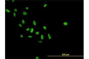 Immunofluorescence of monoclonal antibody to PARP1 on HeLa cell.