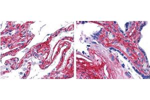 anti collagen V antibody (600-401-107 Lot 22063, 1:200, 45 min RT) showed strong staining in FFPE sections of human lung (left) with strong staining within alveoli, vessels, and in connective tissue spaces; and placenta (right) with strong staining observed in stromal and connective tissue spaces and vessel walls. (Collagen Type V anticorps  (Biotin))