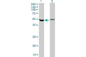 Western Blotting (WB) image for anti-DEAD (Asp-Glu-Ala-Asp) Box Polypeptide 6 (DDX6) (AA 1-484) antibody (ABIN598641) (DDX6 anticorps  (AA 1-484))