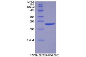 SDS-PAGE analysis of Human NOS1 Protein.