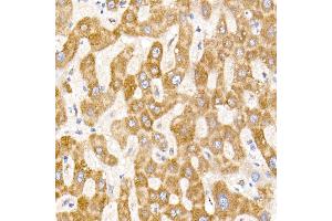 Immunohistochemistry of paraffin-embedded human liver using NDUF Rabbit mAb (ABIN7268797) at dilution of 1:50 (40x lens).