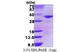 SDS-PAGE (SDS) image for Dehydrogenase/reductase (SDR Family) Member 9 (DHRS9) (AA 18-319) protein (His tag) (ABIN667997) (DHRS9 Protein (AA 18-319) (His tag))