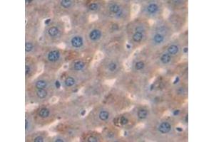 IHC-P analysis of Mouse Tissue, with DAB staining. (LCAT anticorps  (AA 41-210))
