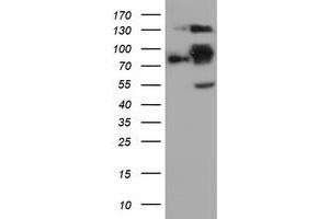 Western Blotting (WB) image for anti-Folate Hydrolase (Prostate-Specific Membrane Antigen) 1 (FOLH1) antibody (ABIN1500455) (PSMA anticorps)