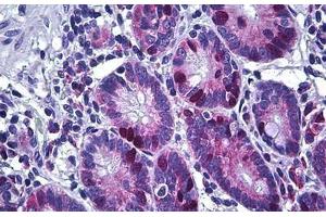 Human Small Intestine: Formalin-Fixed, Paraffin-Embedded (FFPE) (KIFC1 anticorps  (AA 53-152))