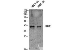 Western Blot (WB) analysis of specific cells using Rad51 Polyclonal Antibody. (RAD51 anticorps  (Thr555))