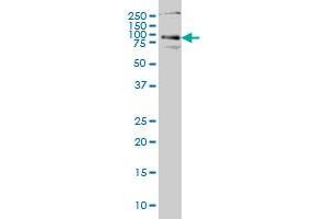 HHIP monoclonal antibody (M01), clone 5D11 Western Blot analysis of HHIP expression in Hela S3 NE .