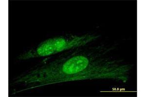 Immunofluorescence of purified MaxPab antibody to ANKRD7 on Hs 181. (ANKRD7 anticorps  (AA 1-201))