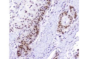 IHC analysis of AHR using anti-AHR antibody (ABIN6719265).